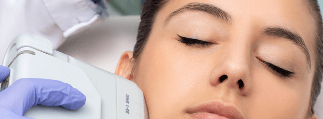 Image of Cryo Facial  service