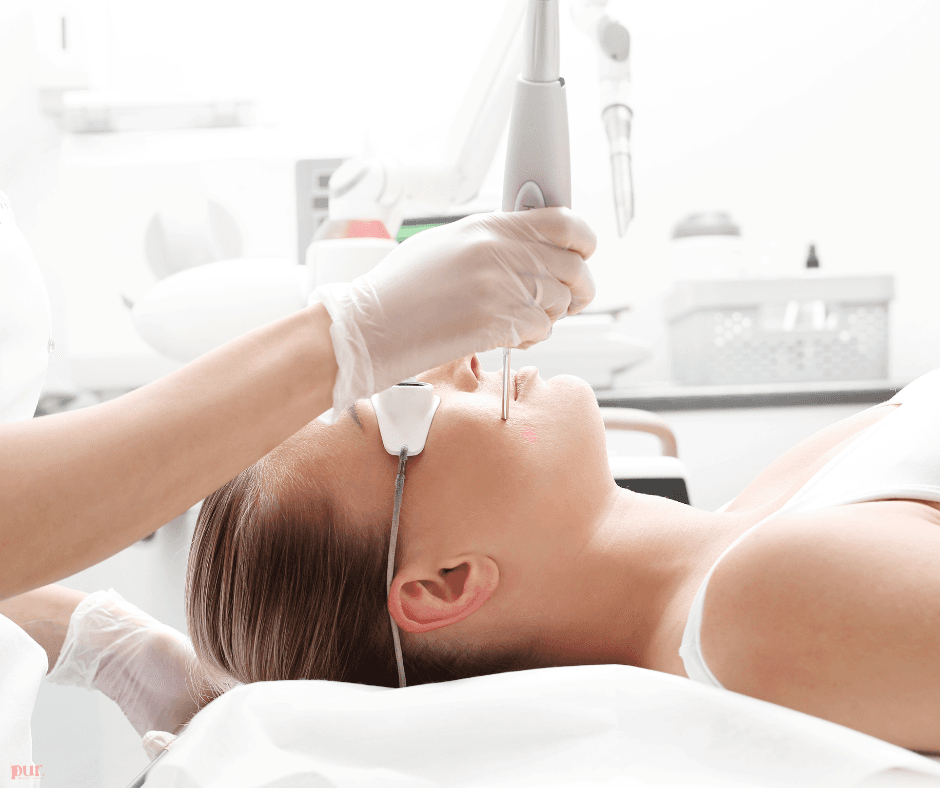 The Guide to  CO2 Laser Treatments