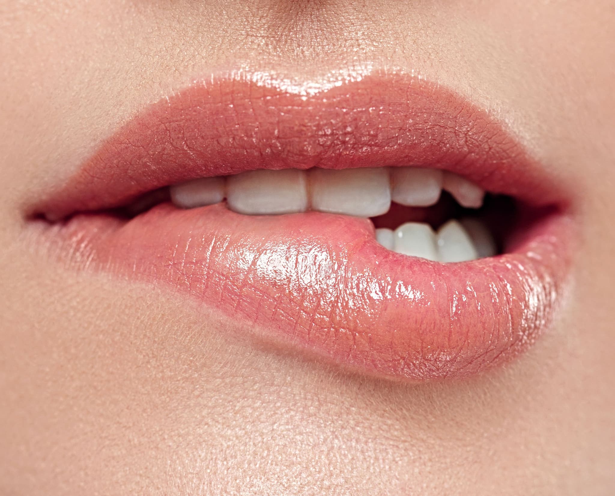 Lip Filler Swelling Stages & Healing Timeline