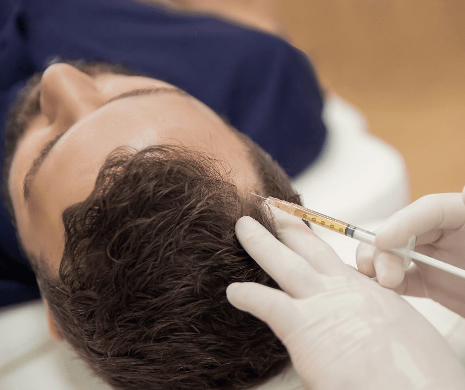 PRP Injections for Hair Loss