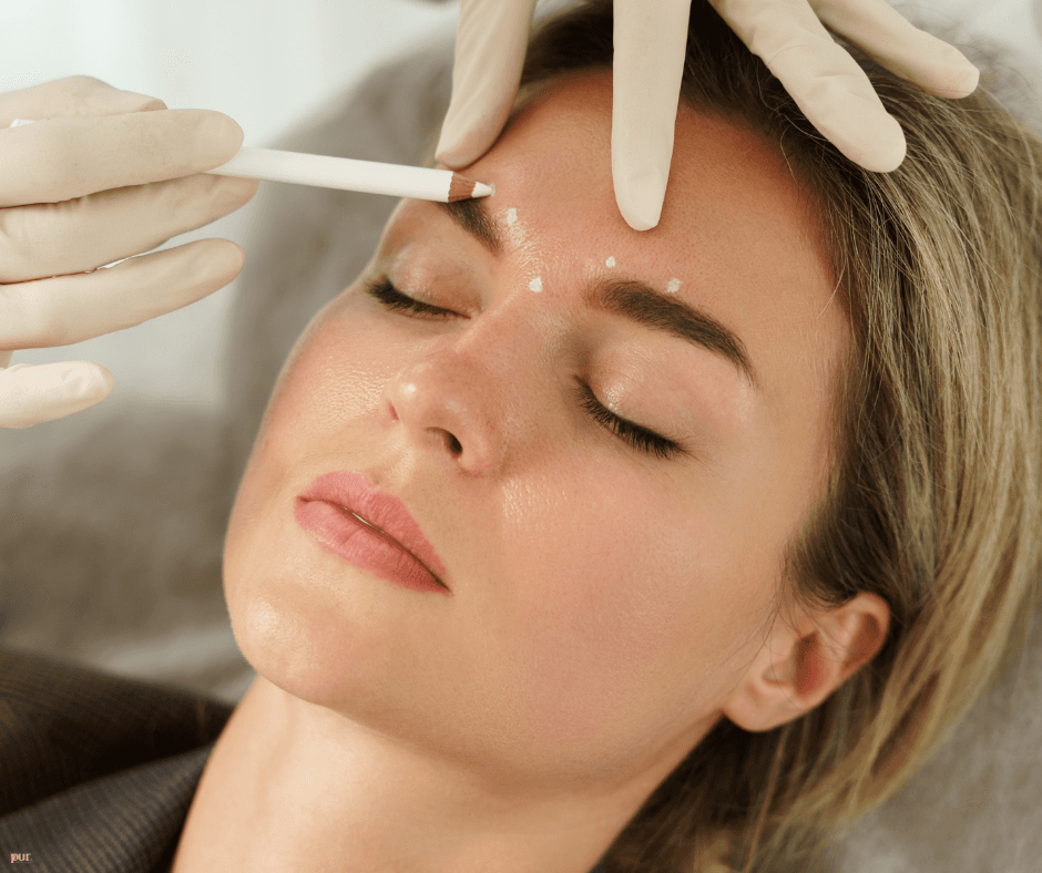 Everything You Need to Know About Juvederm Voluma