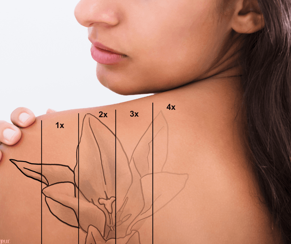 The Ins and Outs of Tattoo Removal: How Long Does It Really Take?